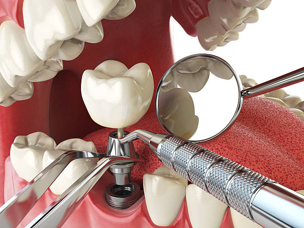 Best Emergency Tooth Extraction in Prairie Creek, AR